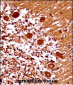 MEOX1 Antibody (Center)